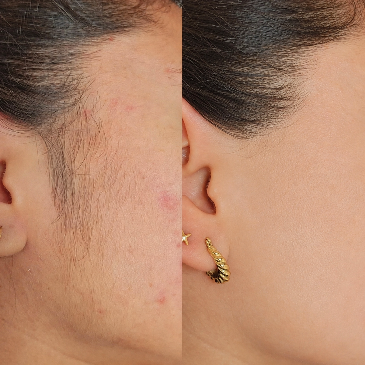RadicePura - Elimina i peli in eccesso (60ml)